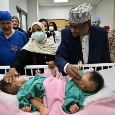 تفاصيل عملية فصل التوأم الصومالي «رحمة ورملا» في الرياض