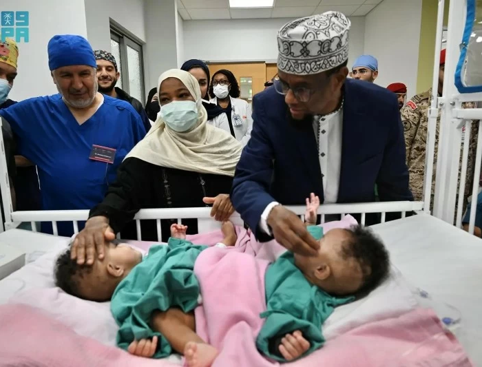 انطلاق عملية فصل التوأم الصومالي رحمة ورملا في الرياض