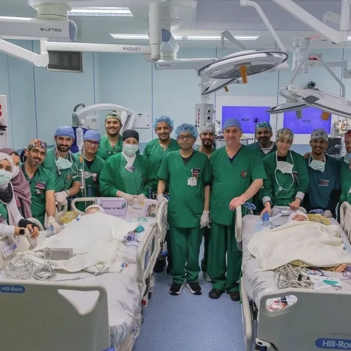 تفاصيل نجاح عملية فصل التوأم الملتصق الفلبيني في الرياض