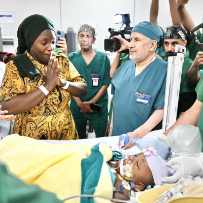 نجاح عملية فصل التوأم الملتصق التنزاني نانسي ونايس