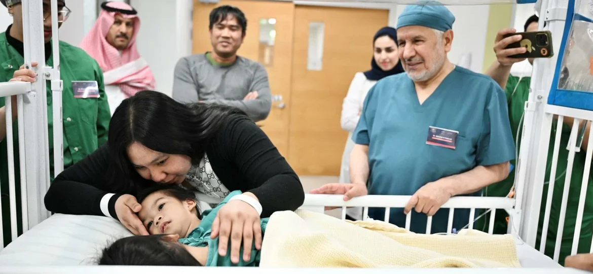 تفاصيل نجاح عملية فصل التوأم الفلبيني أوليفيا وجيانا بالرياض